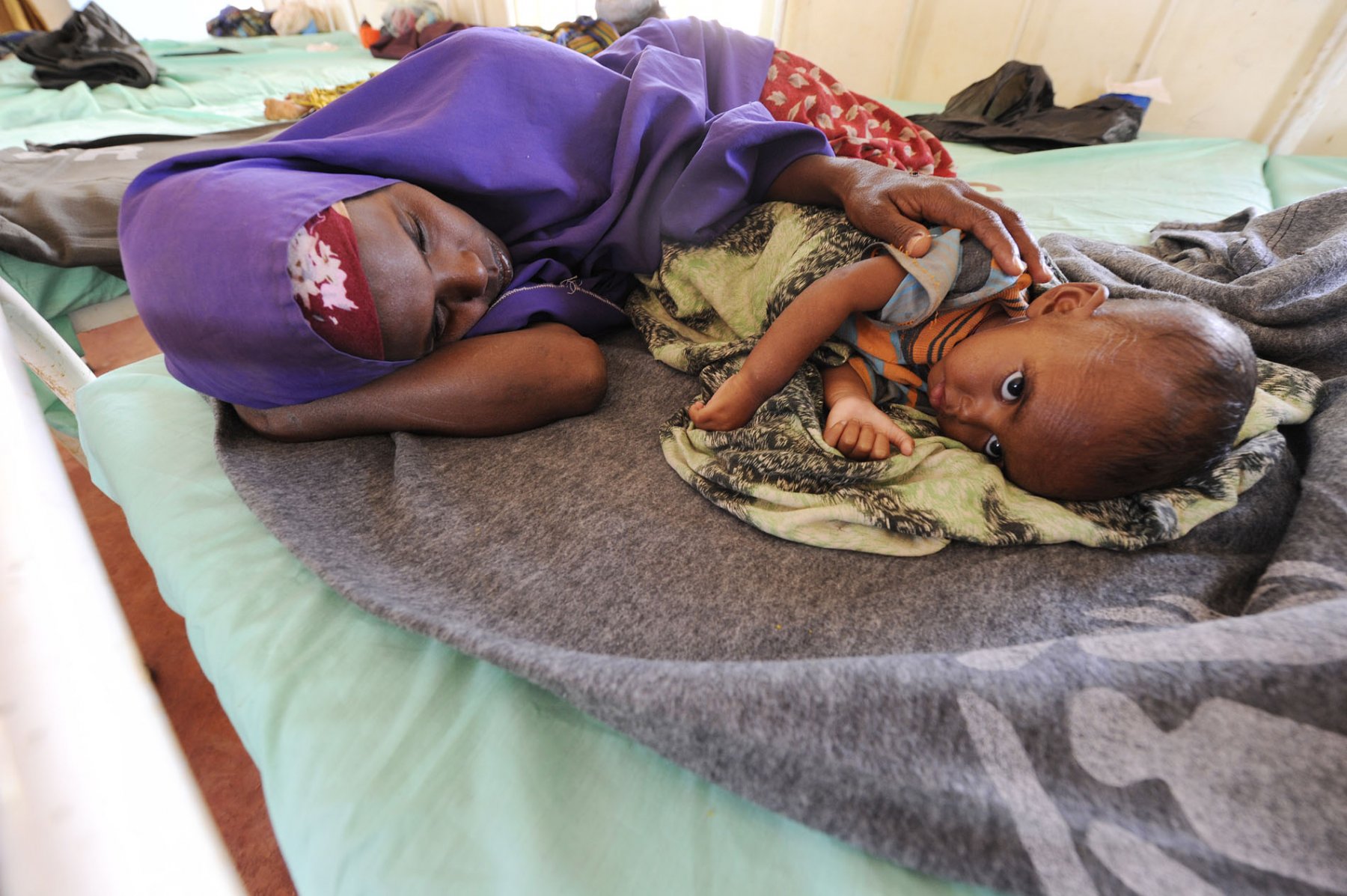 A Somalian mother cradles her malnourished baby in a field hospital in a refugee camp in Dadaab, northeastern Kenya, Wednesday, August 3, 2011. Somalia and parts of Kenya have been struck by one of the worst droughts and famines in six decades, more than 350.000 refugees have found shelter in the worlds biggest refugee camp. Foto: Boris Roessler dpa  +++(c) dpa - Bildfunk+++