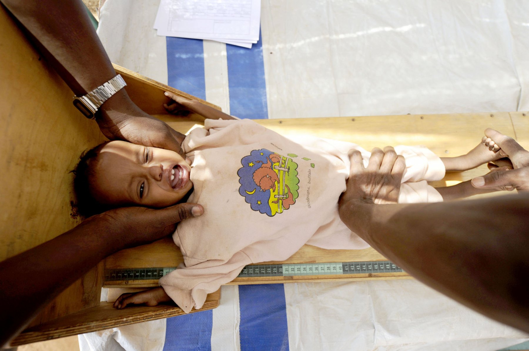 A malnourished child is being checked by doctors at a field hospital inside a refugee camp in Dadaab, northeastern Kenya on thursday, August 4, 2011. Somalia and parts of Kenya have been struck by one of the worst draughts and famines in six decades, more than 350.000 refugees have found shelter in the worlds biggest refugee camp. Photo: Boris Roessler dpa  +++(c) dpa - Bildfunk+++